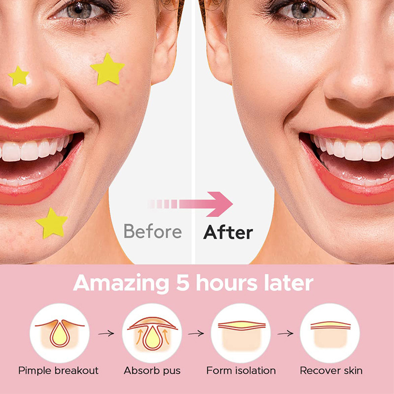600 PCS/Set Star Pimple Patch  - Makeup Beauty Set のレビューと価格